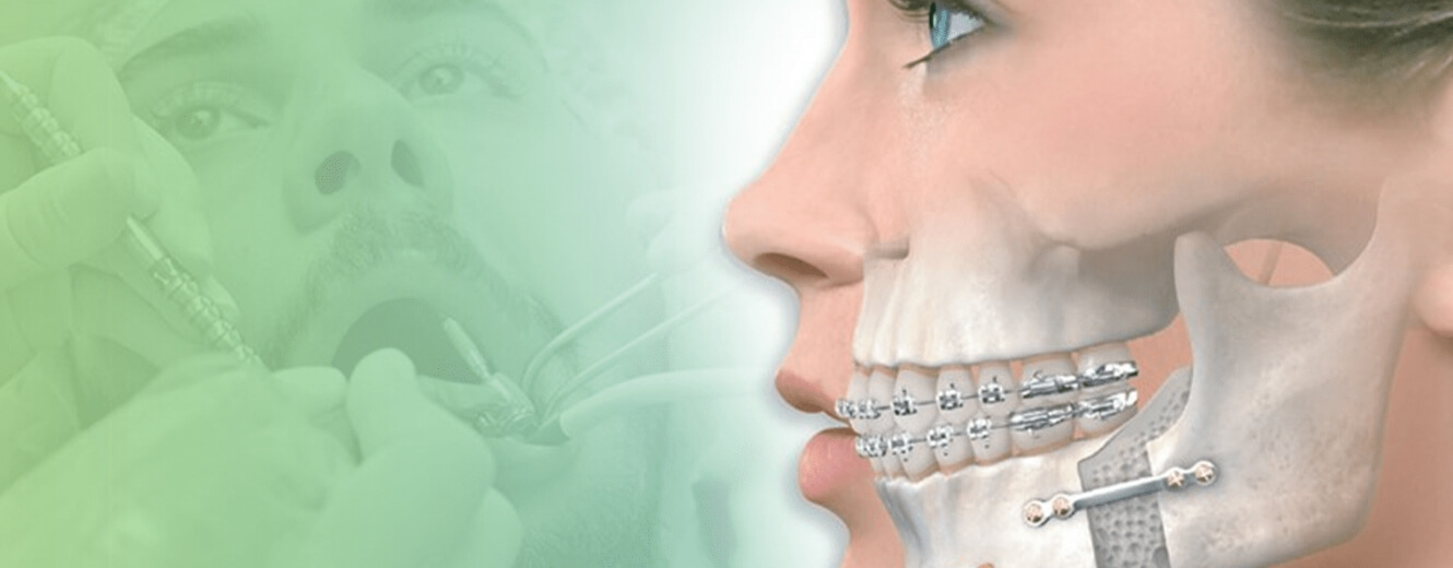 Gaziosmanpaşa Uzman Çene Cerrahları Gaziosmanpaşa Uzman Çene Cerrahları