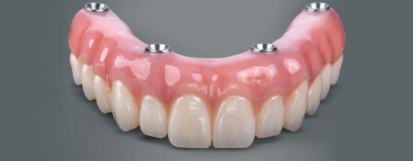 All On Four İmplant İstanbul All On Four İmplant İstanbul