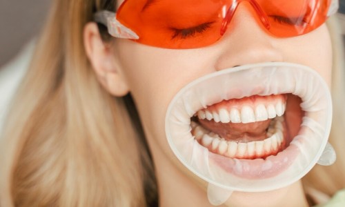 Bayrampaşa Diş Beyazlatma