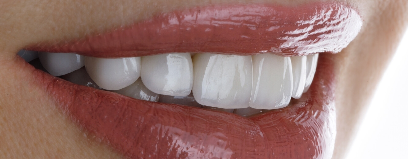 Bayrampaşa Gülüş Tasarımı Bayrampaşa Gülüş Tasarımı