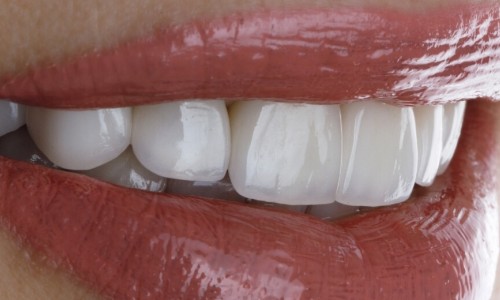 Bayrampaşa Gülüş Tasarımı