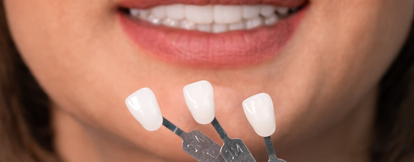 Lamina Kaplama Nedir? Kimler İçin Uygundur? Lamina Kaplama Nedir? Kimler İçin Uygundur?