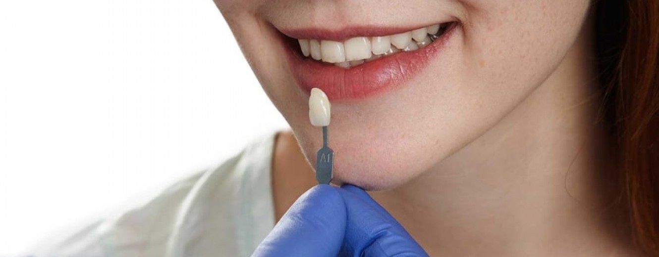 Zirkonyum Kaplama Sonrası Nelere Dikkat Edilmeli? Zirkonyum Kaplama Sonrası Nelere Dikkat Edilmeli?