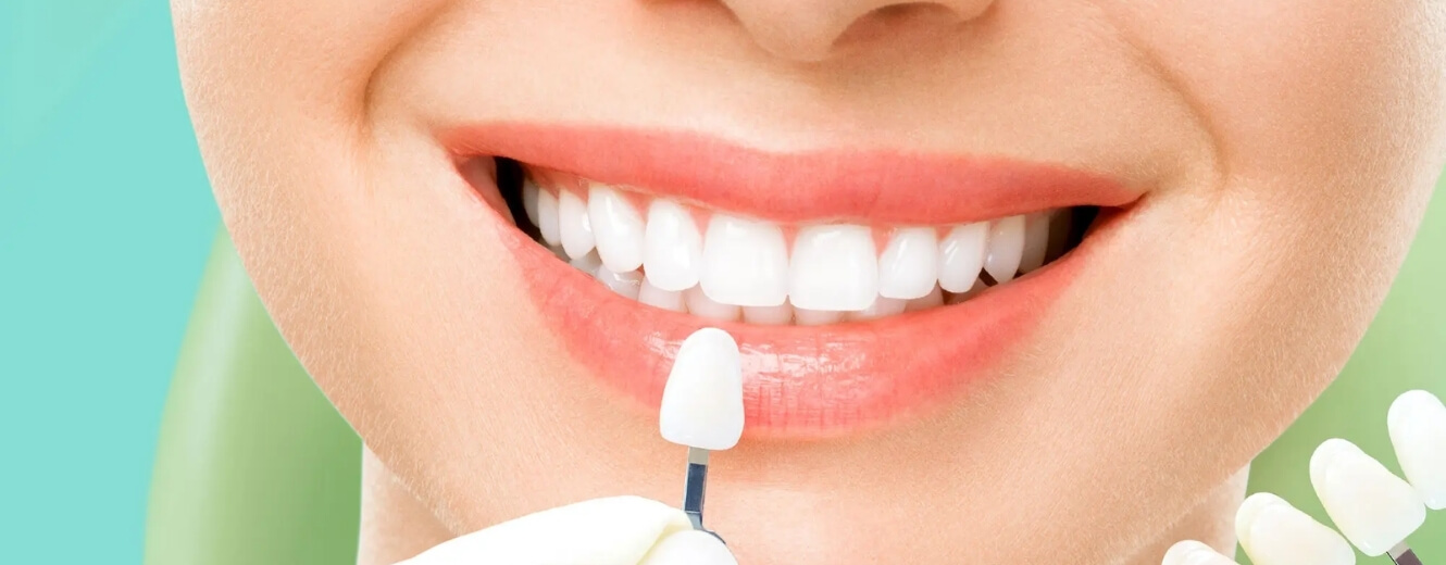 Zirkonyum Diş Kaplama mı, Porselen Kaplama mı Daha Dayanıklı? Zirkonyum Diş Kaplama mı, Porselen Kaplama mı Daha Dayanıklı?