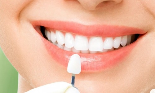 Zirkonyum Diş Kaplama mı, Porselen Kaplama mı Daha Dayanıklı?